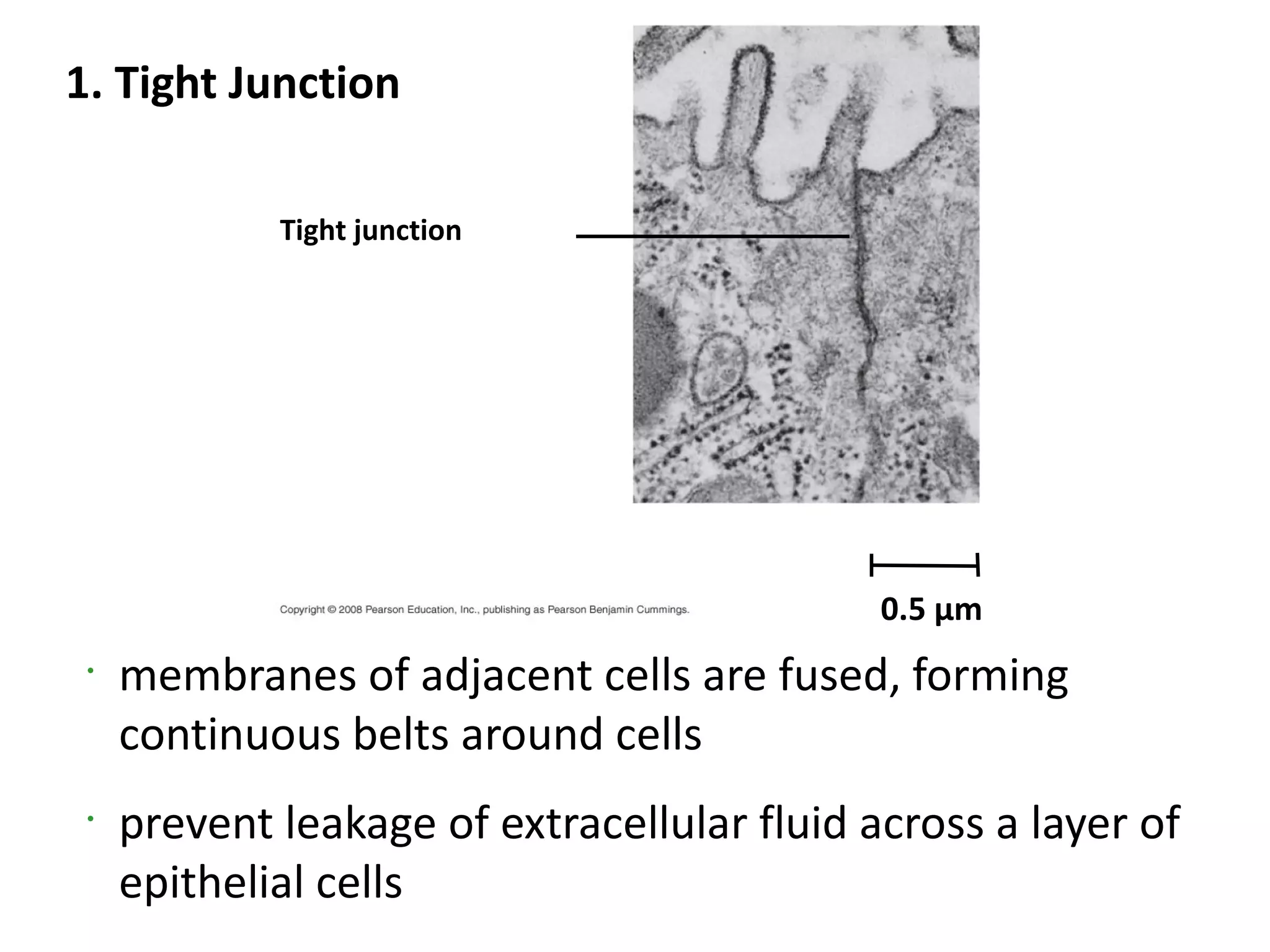 1. Tight Junction

             Tight junction




                                             0.5 µm
 •
     membranes of adjacent cells are fused, forming
     continuous belts around cells
 •
     prevent leakage of extracellular fluid across a layer of
     epithelial cells
 