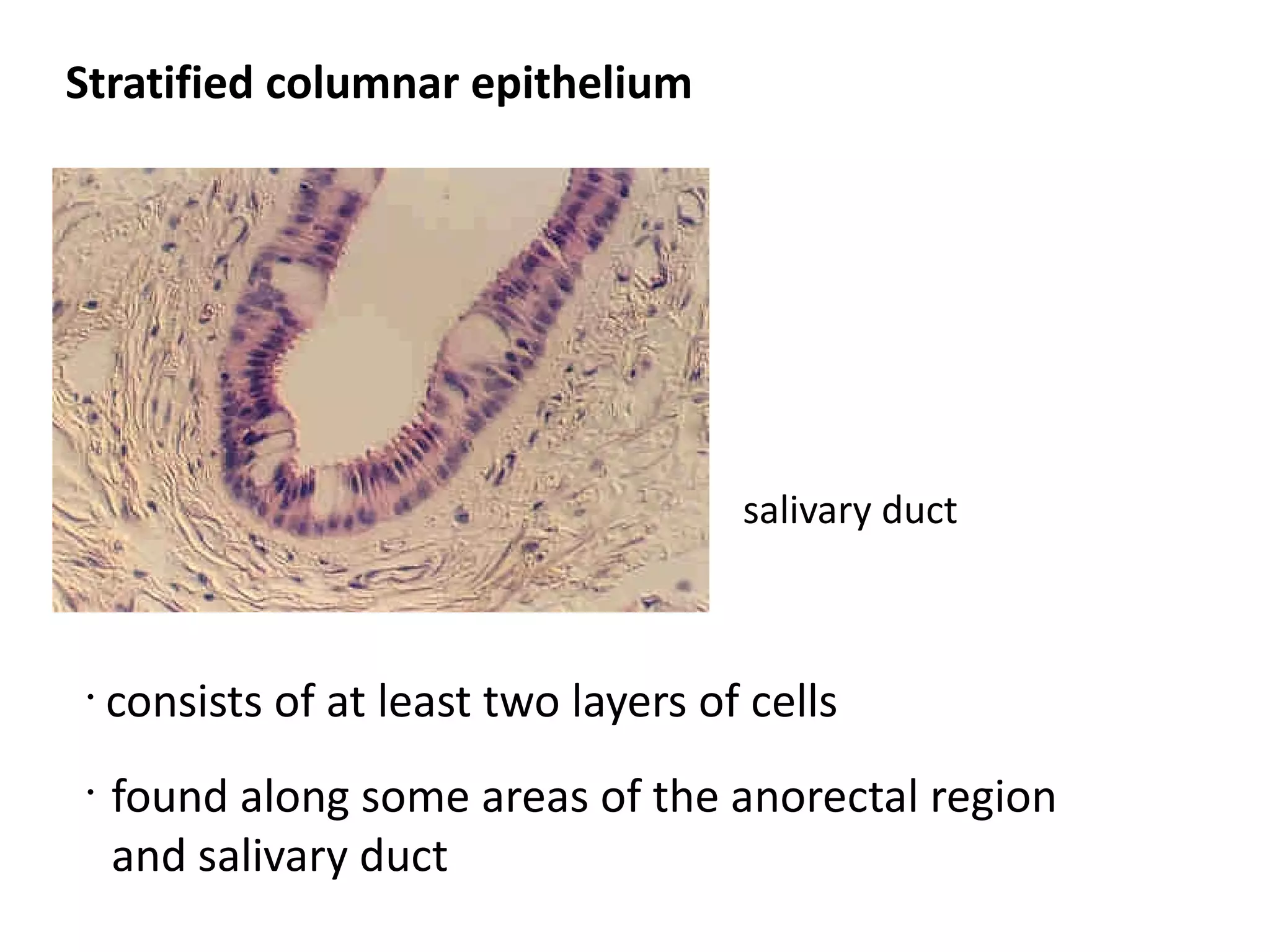 Stratified columnar epithelium




                                       salivary duct



 •
     consists of at least two layers of cells
 •
     found along some areas of the anorectal region
     and salivary duct
 