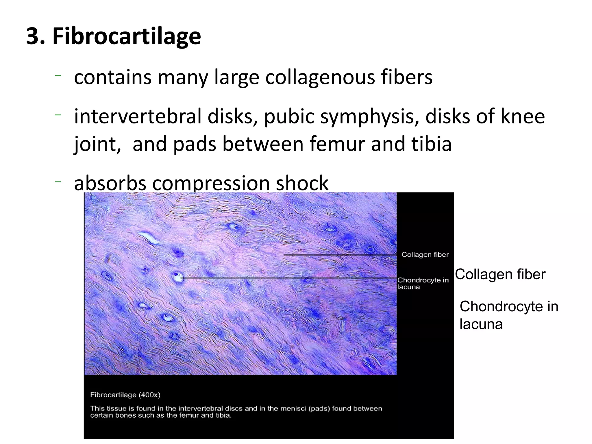 3. Fibrocartilage
  –
      contains many large collagenous fibers
  –
      intervertebral disks, pubic symphysis, disks of knee
      joint, and pads between femur and tibia
  –
      absorbs compression shock


                                               Collagen fiber

                                                Chondrocyte in
                                                lacuna
 