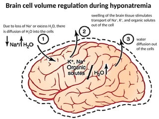 Due to loss of Na+
or excess H2O, there
is diffusion of H2O into the cells
swelling of the brain tissue stimulates
transport of Na+
, K+
, and organic solutes
out of the cell
water
diffusion out
of the cells
Brain cell volume regulation during hyponatremia
 