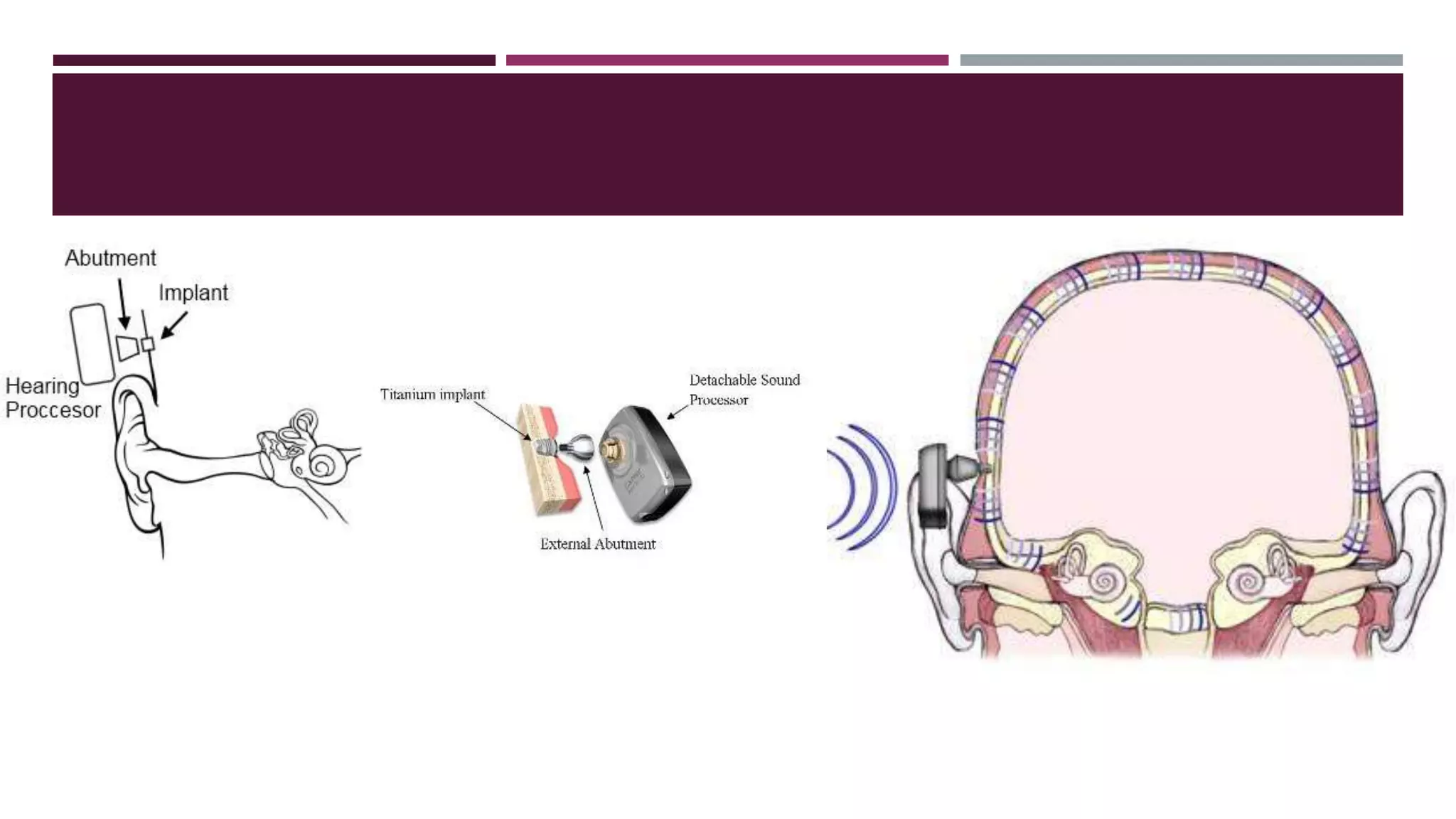 Lecture 1 b principles of amplification
