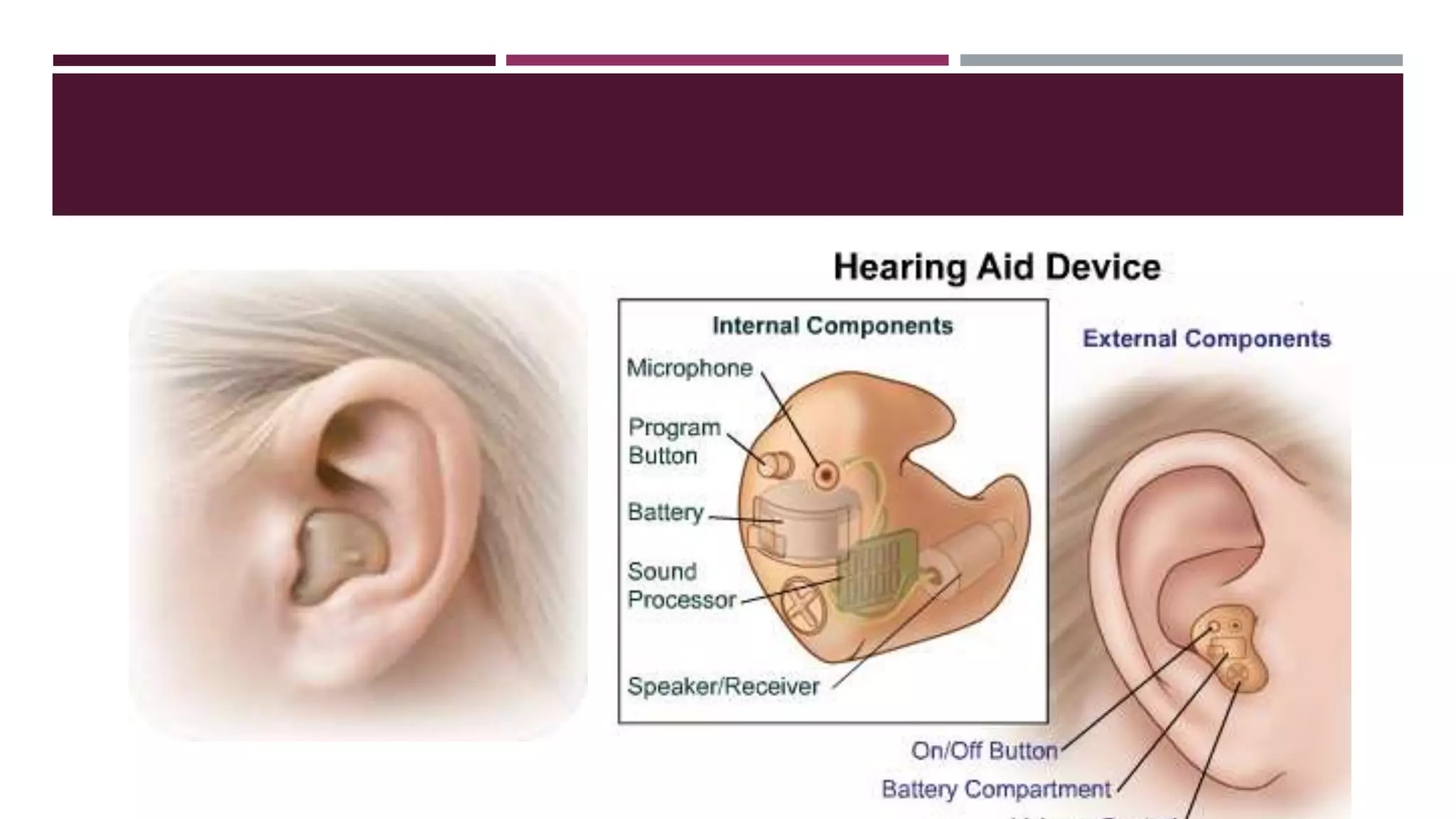 Lecture 1 b principles of amplification
