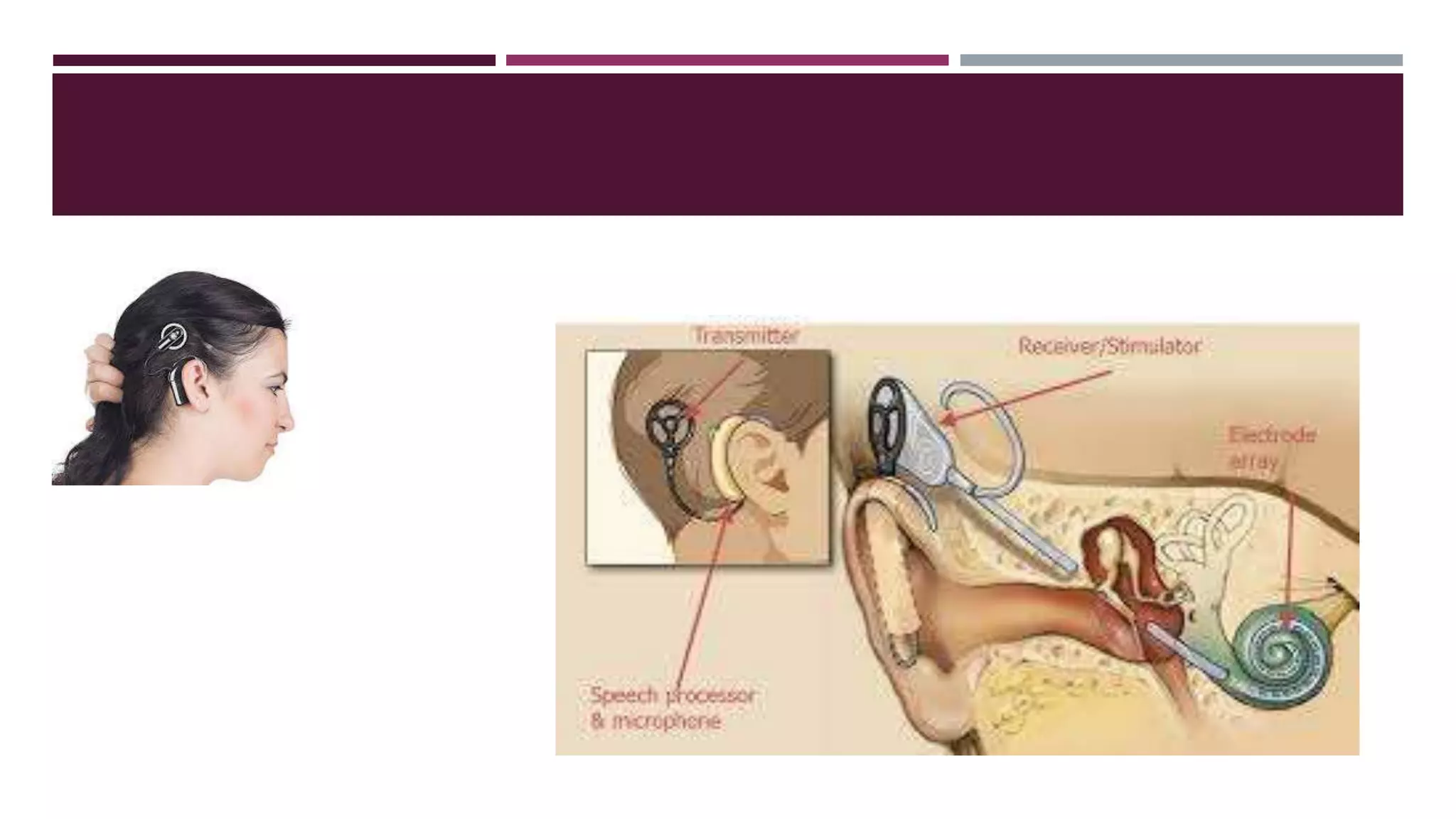 Lecture 1 b principles of amplification