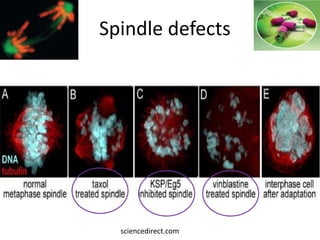 Spindle defects
sciencedirect.com
 