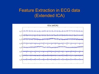 Feature Extraction in ECG data
(Extended ICA)
 
