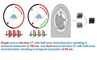 Single-source 64-slice CT with half-scan reconstruction resulting in
temporal resolution of 165 ms and dual-source 64-slice CT with half-scan
reconstruction resulting in temporal resolution of 83 ms .
 