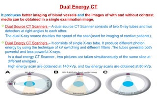 Dual Energy CT
It produces better imaging of blood vessels and the images of with and without contrast
media can be obtained in a single examination image.
 Dual Source CT Scanners – A dual source CT Scanner consists of two X-ray tubes and two
detectors at right angles to each other.
The dual X-ray source doubles the speed of the scan(used for imaging of cardiac patients).
 Dual Energy CT Scanners – It consists of single X-ray tube. It produce different photon
energy by using the technique of kV switching and different filters .The tubes generate both
powerful and less powerful X-rays.
In a dual energy CT Scanner , two pictures are taken simultaneously of the same slice at
different energies .
High energy scan are obtained at 140 kVp, and low energy scans are obtained at 80 kVp.
 