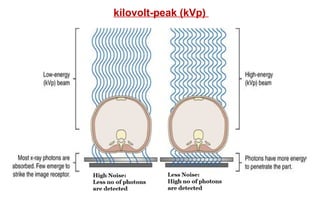 kilovolt-peak (kVp)
 