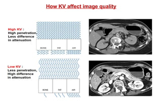 How KV affect image quality
 