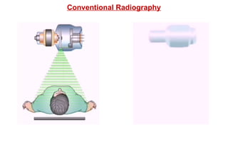 Conventional Radiography
 