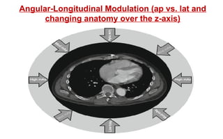 Angular-Longitudinal Modulation (ap vs. lat and
changing anatomy over the z-axis)
 
