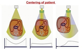 Centering of patient
 