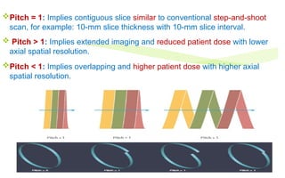 Pitch = 1: Implies contiguous slice similar to conventional step-and-shoot
scan, for example: 10-mm slice thickness with 10-mm slice interval.
 Pitch > 1: Implies extended imaging and reduced patient dose with lower
axial spatial resolution.
Pitch < 1: Implies overlapping and higher patient dose with higher axial
spatial resolution.
 