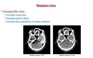 Increase Rot. time :
Increase scan time
Increase patient dose
Increase the probability of motion artifacts
Rotation time
 