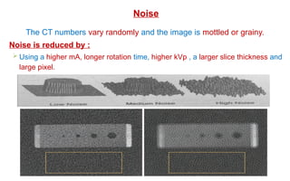 The CT numbers vary randomly and the image is mottled or grainy.
Noise is reduced by :
 Using a higher mA, longer rotation time, higher kVp , a larger slice thickness and
large pixel.
Noise
 