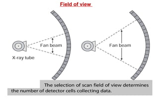 Field of view & The spatial resolution
Field of view
 