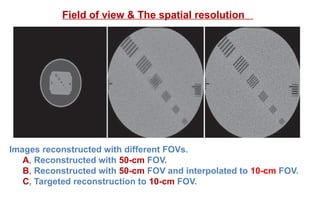 Images reconstructed with different FOVs.
A, Reconstructed with 50-cm FOV.
B, Reconstructed with 50-cm FOV and interpolated to 10-cm FOV.
C, Targeted reconstruction to 10-cm FOV.
Field of view & The spatial resolution
 
