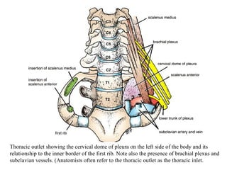 Thoracic outlet showing the cervical dome of pleura on the left side of the body and its relationship to the inner border of the first rib. Note also the presence of brachial plexus and subclavian vessels. (Anatomists often refer to the thoracic outlet as the thoracic inlet .  