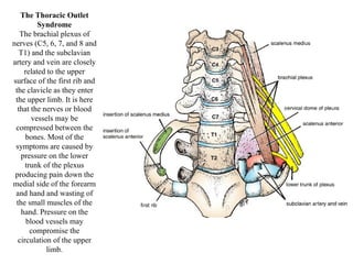 The Thoracic Outlet Syndrome The brachial plexus of nerves (C5, 6, 7, and 8 and T1) and the subclavian artery and vein are closely related to the upper surface of the first rib and the clavicle as they enter the upper limb .  It is here that the nerves or blood vessels may be compressed between the bones. Most of the symptoms are caused by pressure on the lower trunk of the plexus producing pain down the medial side of the forearm and hand and wasting of the small muscles of the hand. Pressure on the blood vessels may compromise the circulation of the upper limb . 