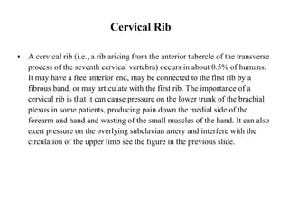 A cervical rib  ( i . e . , a rib arising from the anterior tubercle of the transverse process of the seventh cervical vertebra )  occurs in about 0.5% of humans. It may have a free anterior end, may be connected to the first rib by a fibrous band, or may articulate with the first rib .  The importance of a cervical rib is that it can cause pressure on the lower trunk of the brachial plexus in some patients, producing pain down the medial side of the forearm and hand and wasting of the small muscles of the hand .  It can also exert pressure on the overlying subclavian artery and interfere with the circulation of the upper limb see the figure in the previous slide . Cervical Rib 