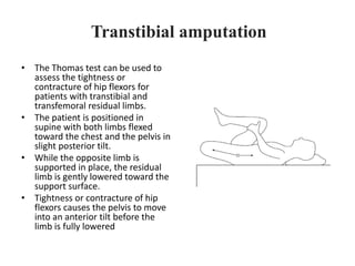 • The Thomas test can be used to
assess the tightness or
contracture of hip flexors for
patients with transtibial and
transfemoral residual limbs.
• The patient is positioned in
supine with both limbs flexed
toward the chest and the pelvis in
slight posterior tilt.
• While the opposite limb is
supported in place, the residual
limb is gently lowered toward the
support surface.
• Tightness or contracture of hip
flexors causes the pelvis to move
into an anterior tilt before the
limb is fully lowered
Transtibial amputation
 