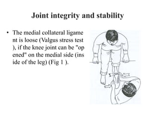 • The medial collateral ligame
nt is loose (Valgus stress test
), if the knee joint can be "op
ened" on the medial side (ins
ide of the leg) (Fig 1 ).
Joint integrity and stability
 
