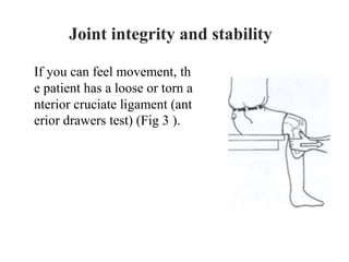 If you can feel movement, th
e patient has a loose or torn a
nterior cruciate ligament (ant
erior drawers test) (Fig 3 ).
Joint integrity and stability
 
