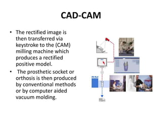 CAD-CAM
• The rectified image is
then transferred via
keystroke to the (CAM)
milling machine which
produces a rectified
positive model.
• The prosthetic socket or
orthosis is then produced
by conventional methods
or by computer aided
vacuum molding.
 
