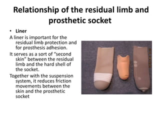 Relationship of the residual limb and
prosthetic socket
• Liner
A liner is important for the
residual limb protection and
for prosthesis adhesion.
It serves as a sort of “second
skin” between the residual
limb and the hard shell of
the socket.
Together with the suspension
system, it reduces friction
movements between the
skin and the prosthetic
socket
 