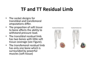 TF and TT Residual Limb
• The socket designs for
transtibial and transfemoral
amputations differ.
• The proportion of soft tissue
to bone affects the ability to
withstand pressure load.
• The transtibial residual limb
has two bones with little soft
tissue coverage (see Figure).
• The transfemoral residual limb
has only one bone which is
surrounded by powerful
muscles (soft tissue)
 