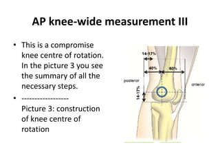 AP knee-wide measurement III
• This is a compromise
knee centre of rotation.
In the picture 3 you see
the summary of all the
necessary steps.
• ------------------
Picture 3: construction
of knee centre of
rotation
 