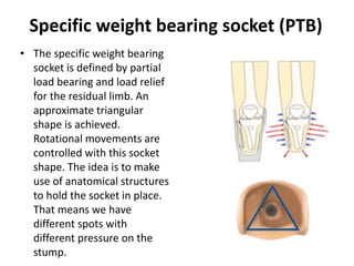 Specific weight bearing socket (PTB)
• The specific weight bearing
socket is defined by partial
load bearing and load relief
for the residual limb. An
approximate triangular
shape is achieved.
Rotational movements are
controlled with this socket
shape. The idea is to make
use of anatomical structures
to hold the socket in place.
That means we have
different spots with
different pressure on the
stump.
 