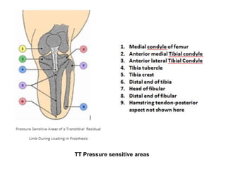 TT Pressure sensitive areas
 