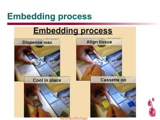 Embedding process
Histopathology
 