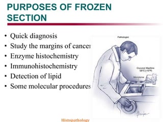 PURPOSES OF FROZEN
SECTION
• Quick diagnosis
• Study the margins of cancer
• Enzyme histochemistry
• Immunohistochemistry
• Detection of lipid
• Some molecular procedures
Histopathology
 