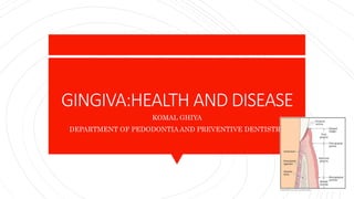 GINGIVA:HEALTH AND DISEASE
KOMAL GHIYA
DEPARTMENT OF PEDODONTIA AND PREVENTIVE DENTISTRY
 