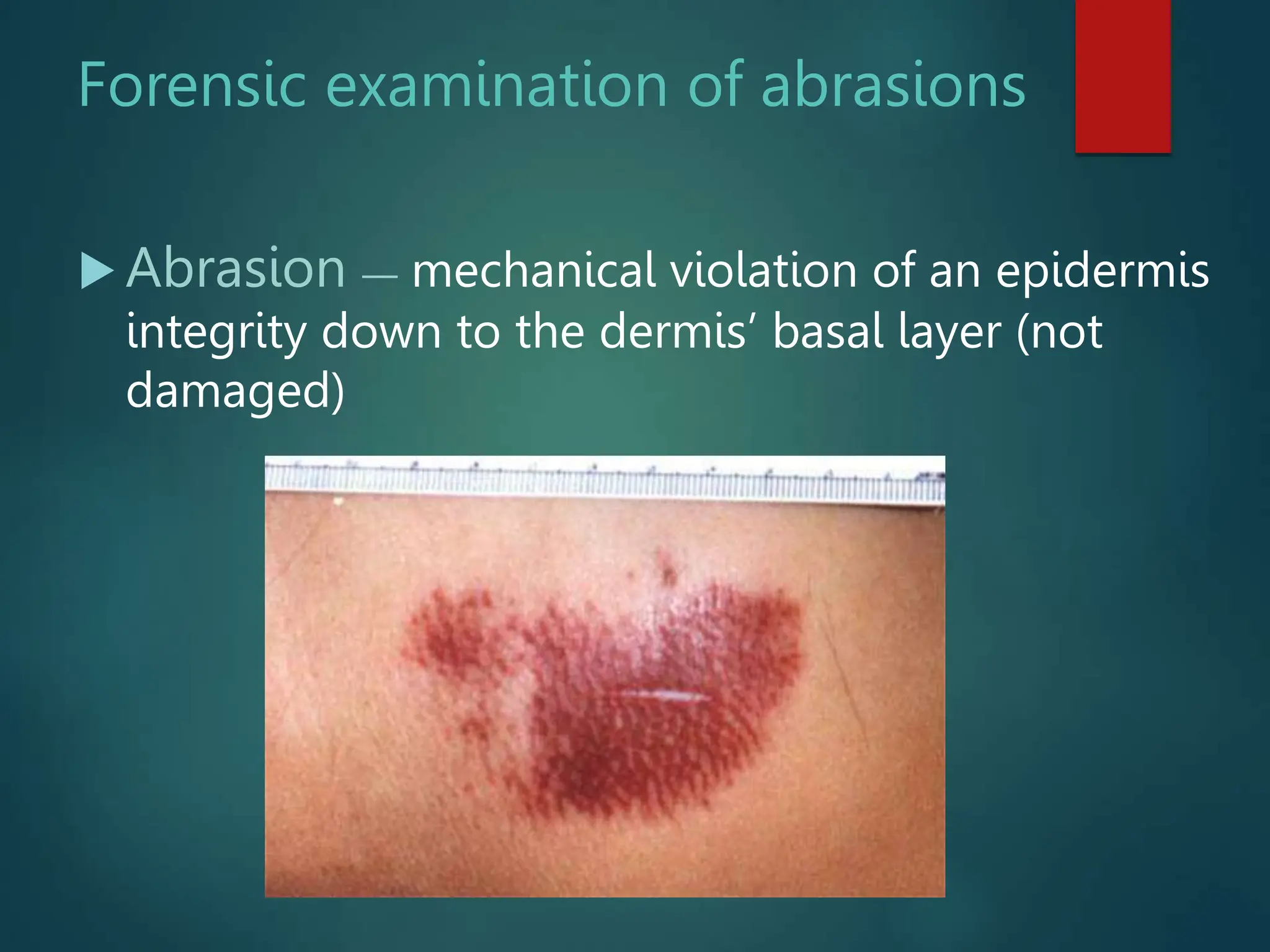 Lecture 2. Forensic traumatology.ppt