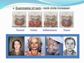 internal medicine endocrine syndrome of hypo and hypothyroidism | PDF