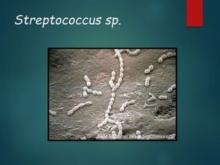 Streptococcus sp.
 