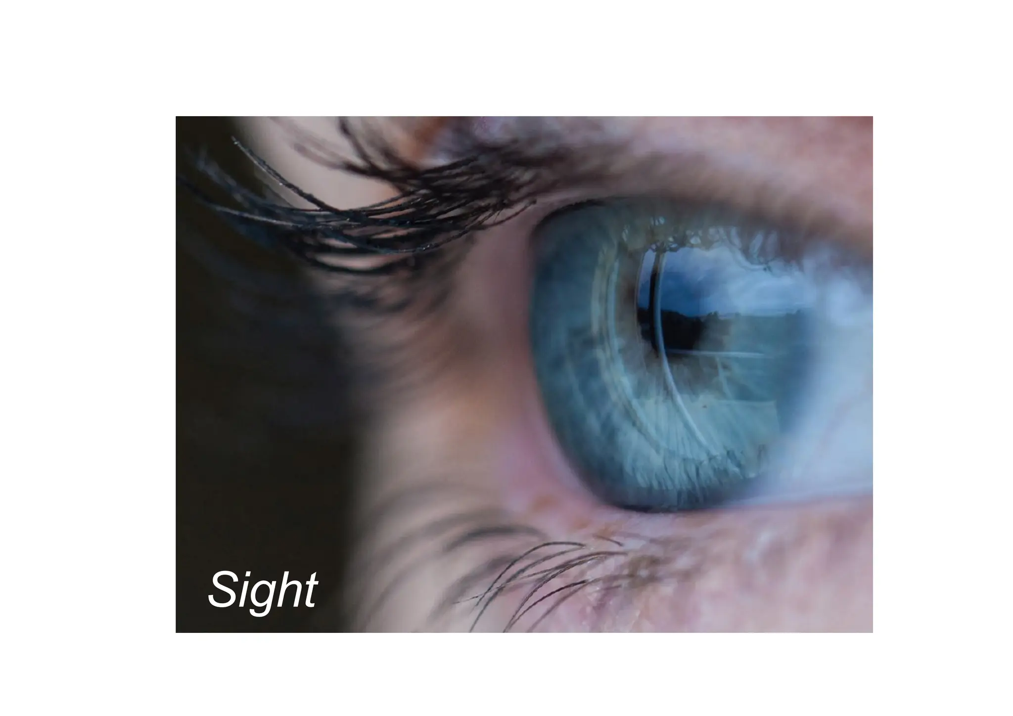 Sight
 