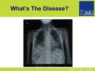 What’s The Disease? 