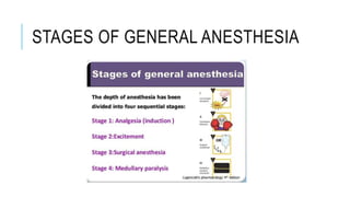 STAGES OF GENERAL ANESTHESIA
 
