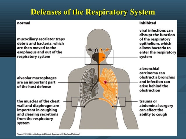 How Does The Respiratory System Protect Itself From Infection