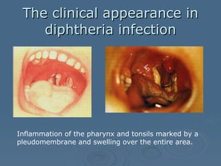 Bohomolets Microbiology Lecture #20 | PPT