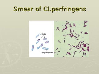 Smear of Cl.perfringens 