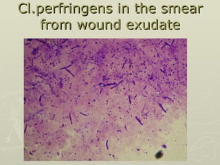 Cl.perfringens in the smear from wound exudate 