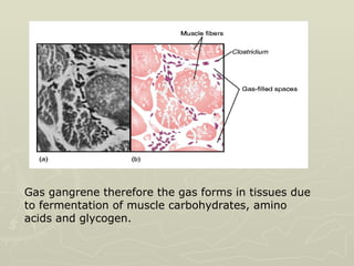 Gas gangrene therefore the gas forms in tissues due to fermentation of muscle carbohydrates, amino acids and glycogen.  