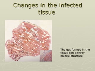 Changes in the infected tissue  The gas formed in the tissue can destroy muscle structure  