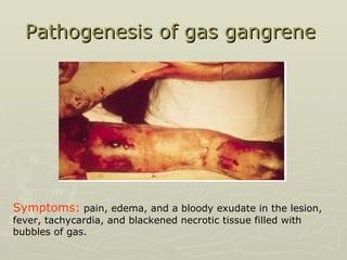 Pathogenesis of gas gangrene  Symptoms:  pain, edema, and a bloody exudate in the lesion, fever, tachycardia, and blackened necrotic tissue filled with bubbles of gas.  