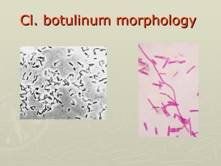 Cl. botulinum morphology   